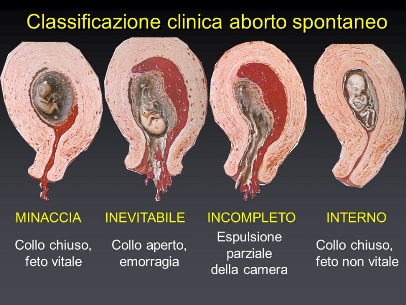 BAUNA Collana Mamma Angelo - Regalo Commemorativo Per Aborto Spontaneo Con Timbro E Sacchetto In Velluto