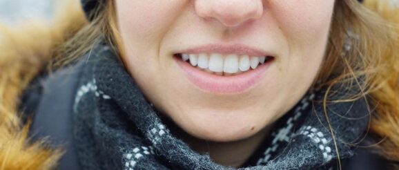 cosa sono le faccette estetiche cosa sono le faccette estetiche