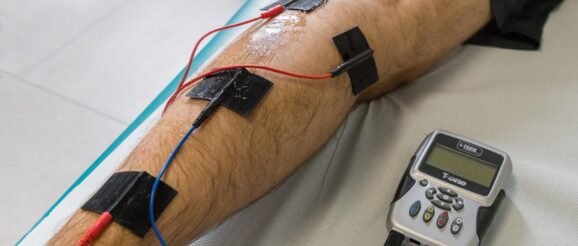 Elettrostimolazione_800x533